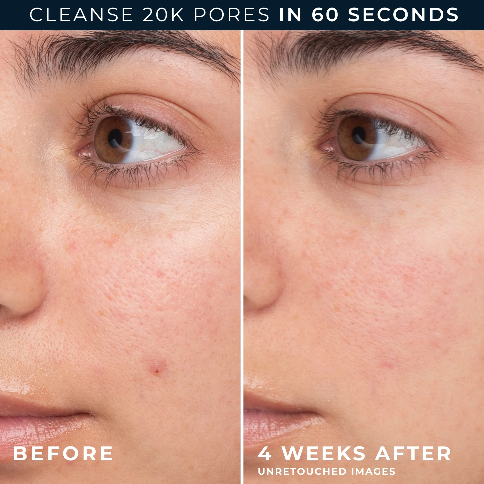 Barrier Renew® Gel-To-Foam Cleanser - Image 5