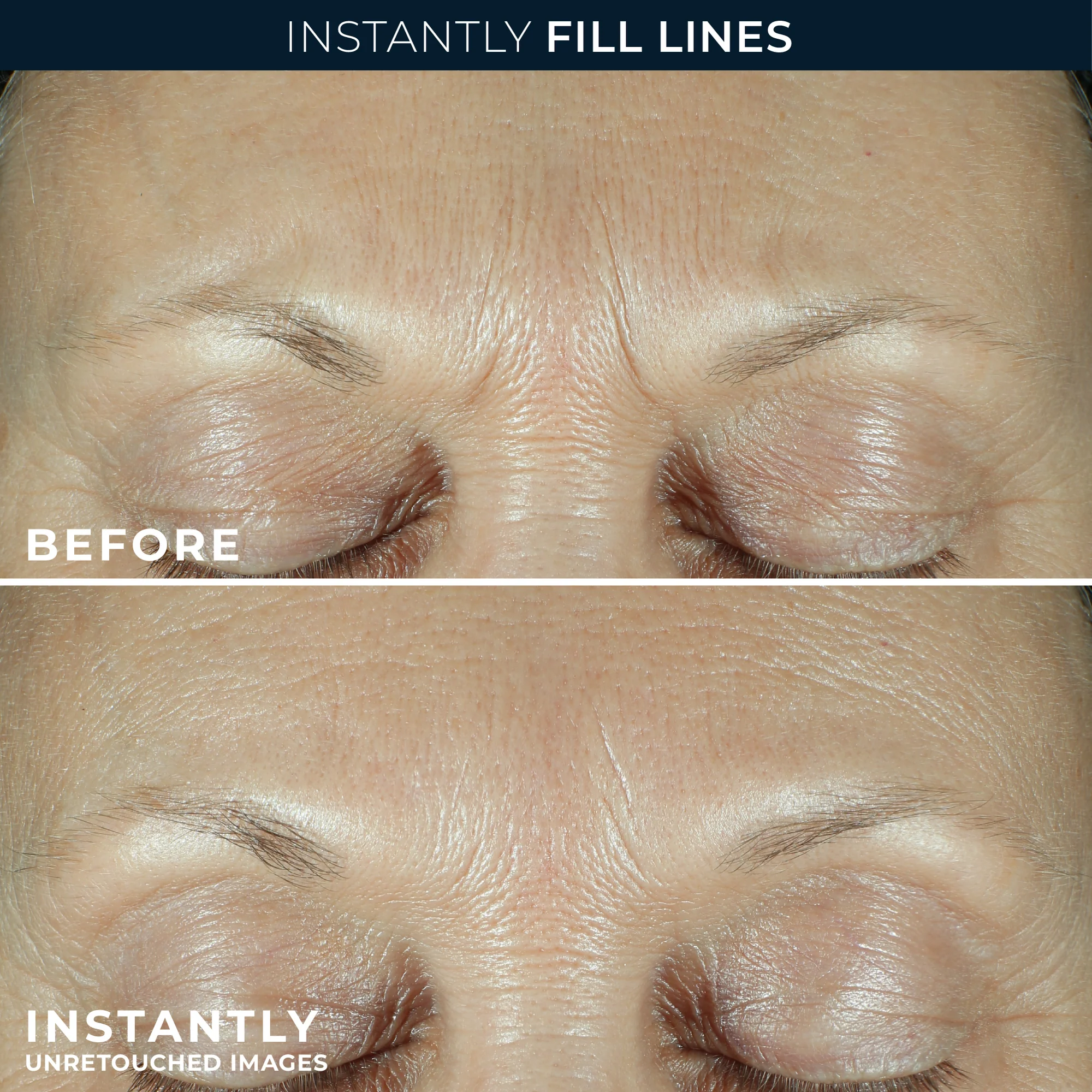 DERM CORREXION® Fill + Treat Serum - Image 4