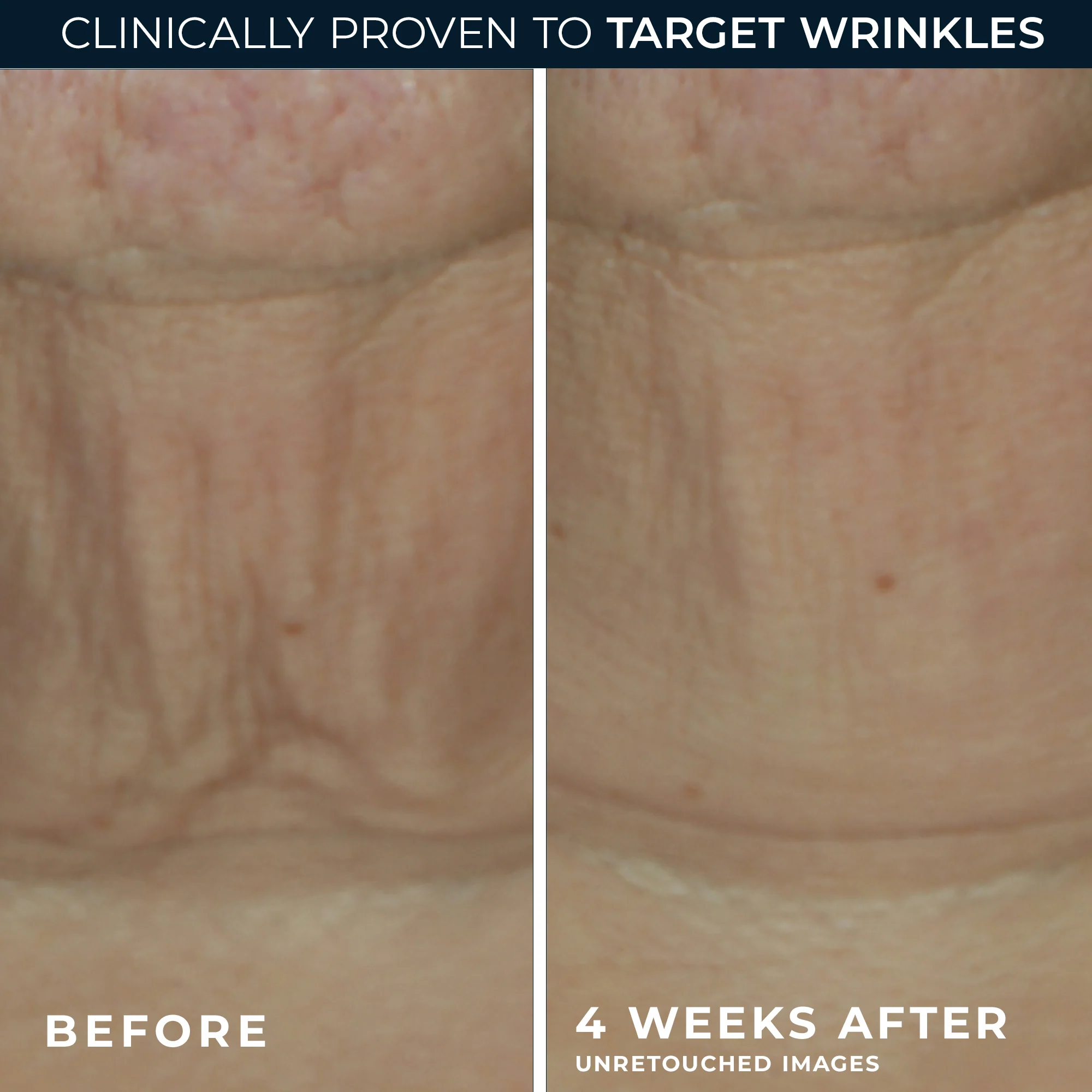 DERM CORREXION® Firming Serum Stick - Image 4