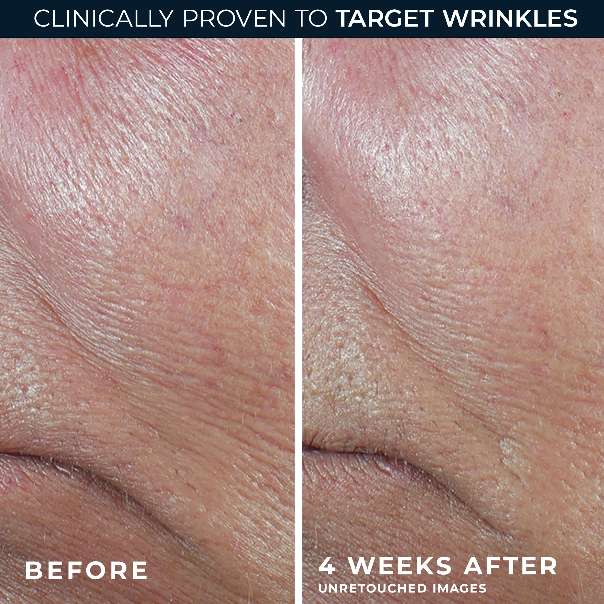 DERM CORREXION® Firming Serum Stick - Image 5