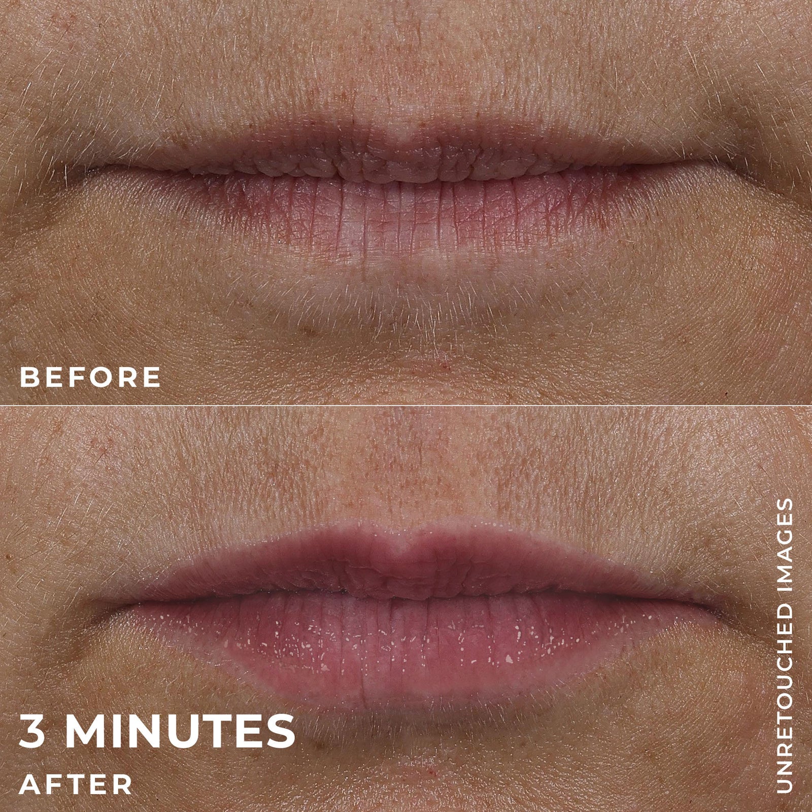 DERM CORREXION® Lip Volumizer - Image 5