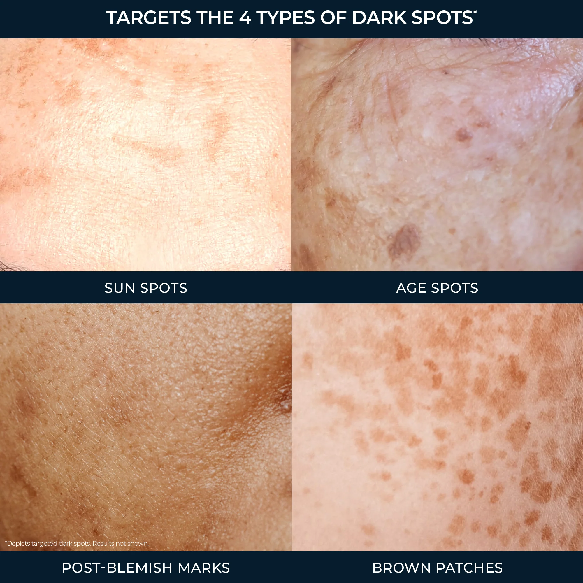 Even Tone Roll-On Serum - Image 5