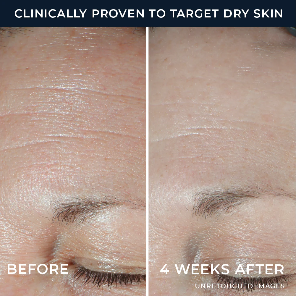 Hydration+ Moisturizer - Image 4