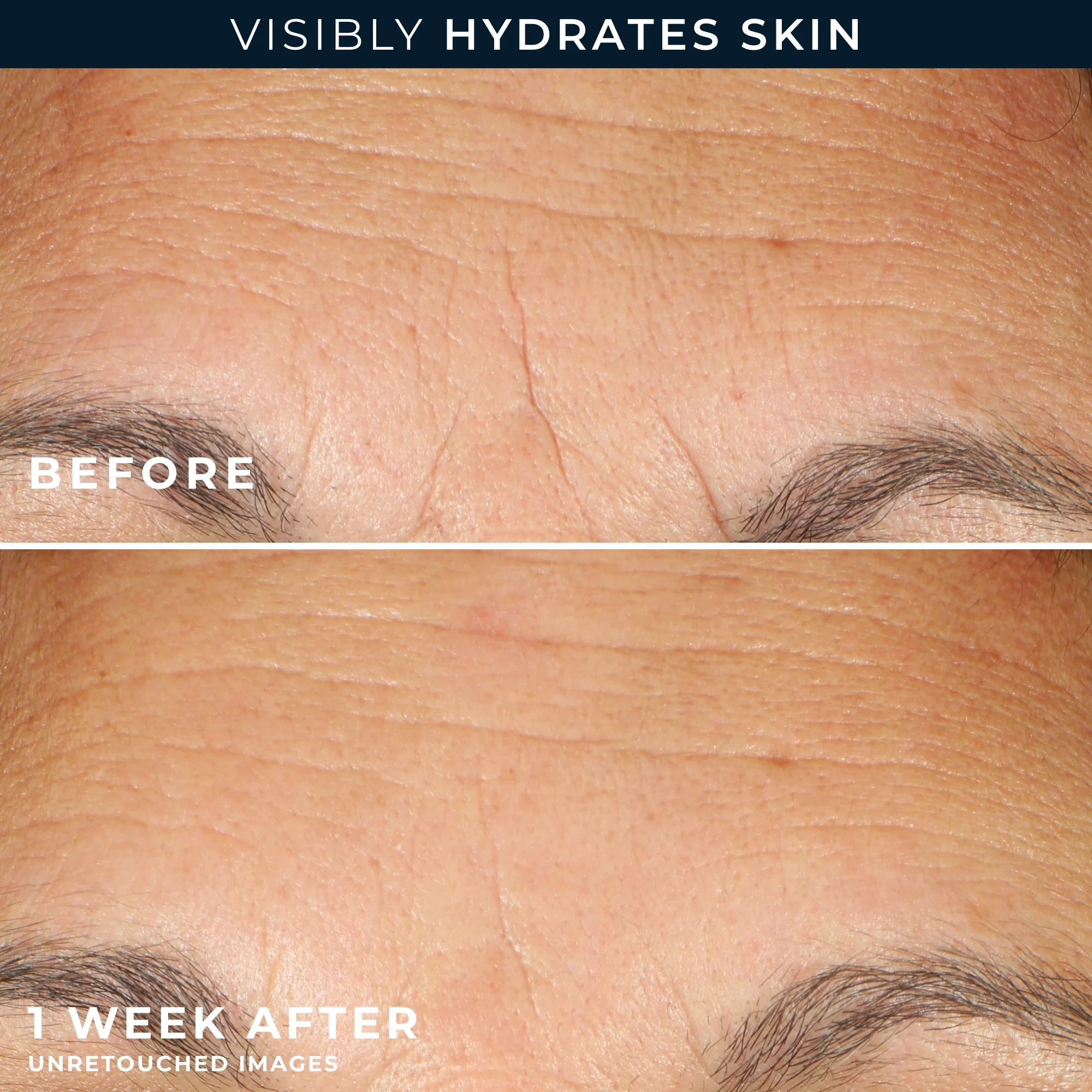 Hydration+ Serum Capsules - Image 5