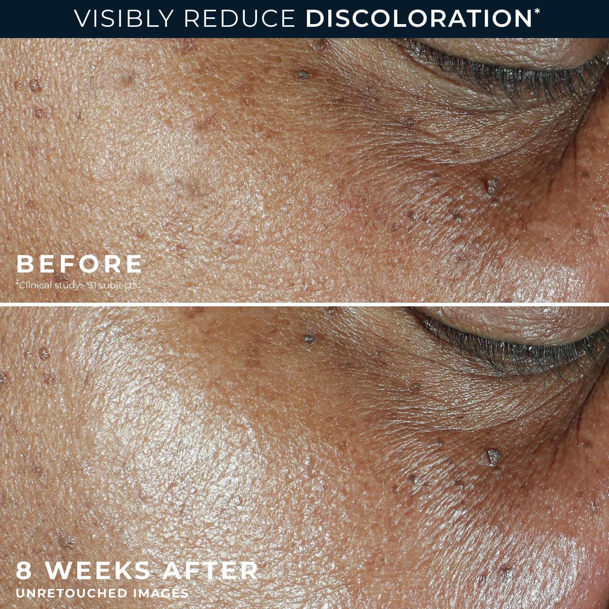 MULTI CORREXION® Even Tone + Lift Daily Moisturizer SPF 30 - Image 5