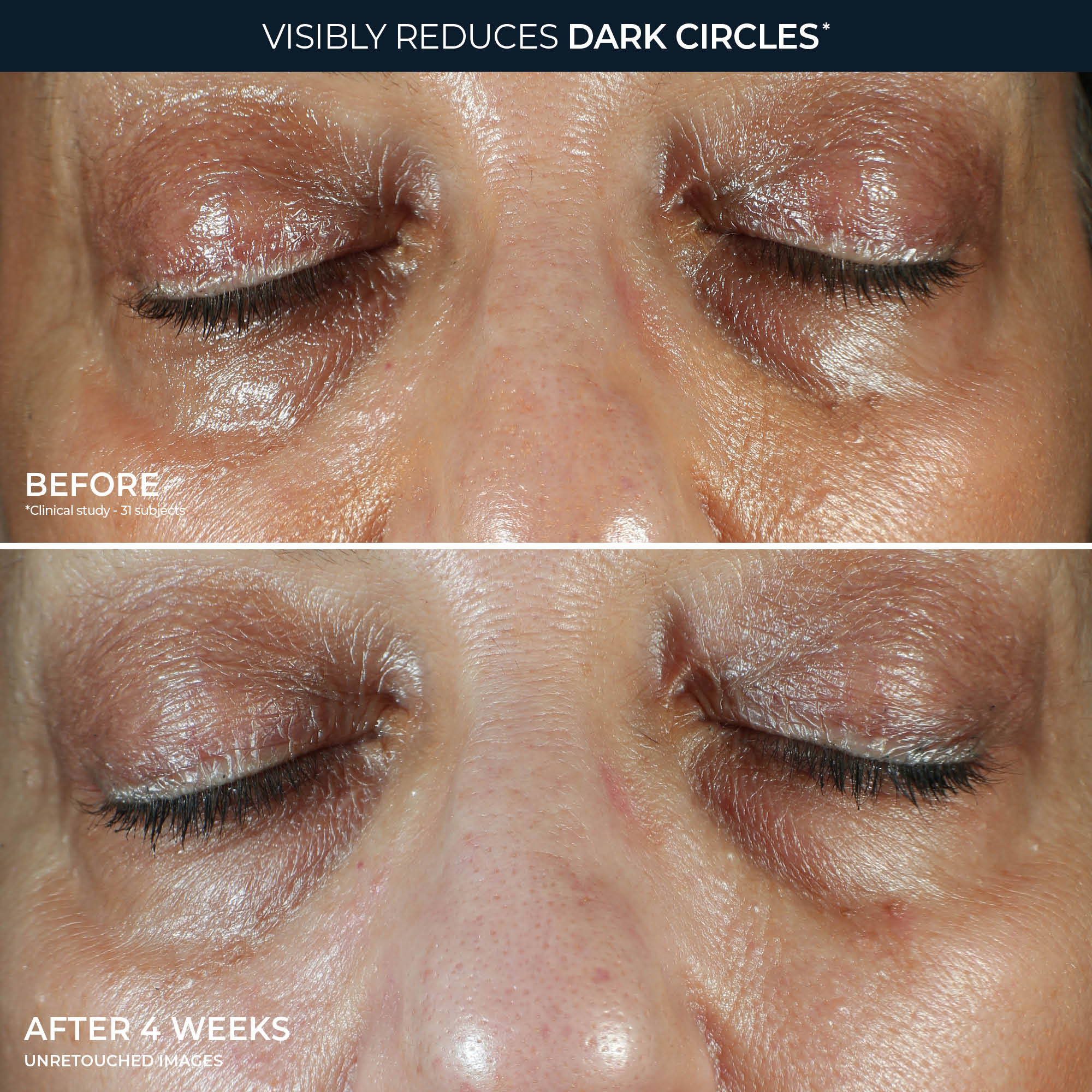 MULTI CORREXION® Even Tone + Lift Eye Cream - Image 5