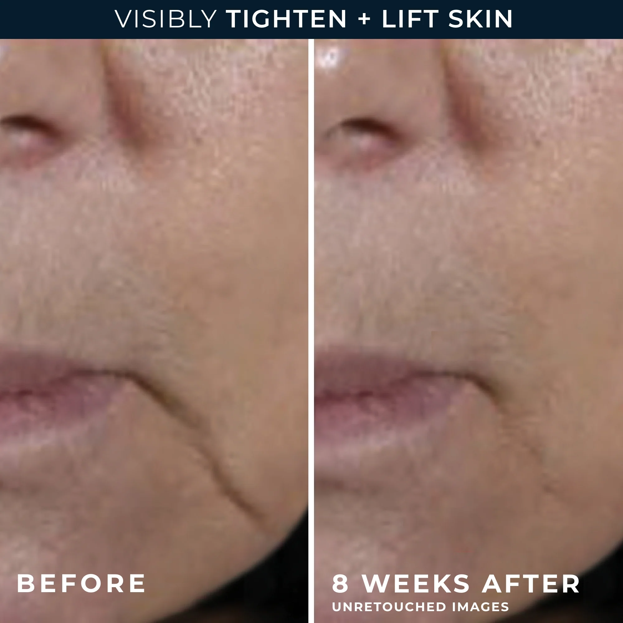 MULTI CORREXION® Firm + Lift Anti-Sagging Firming Cream - Image 5
