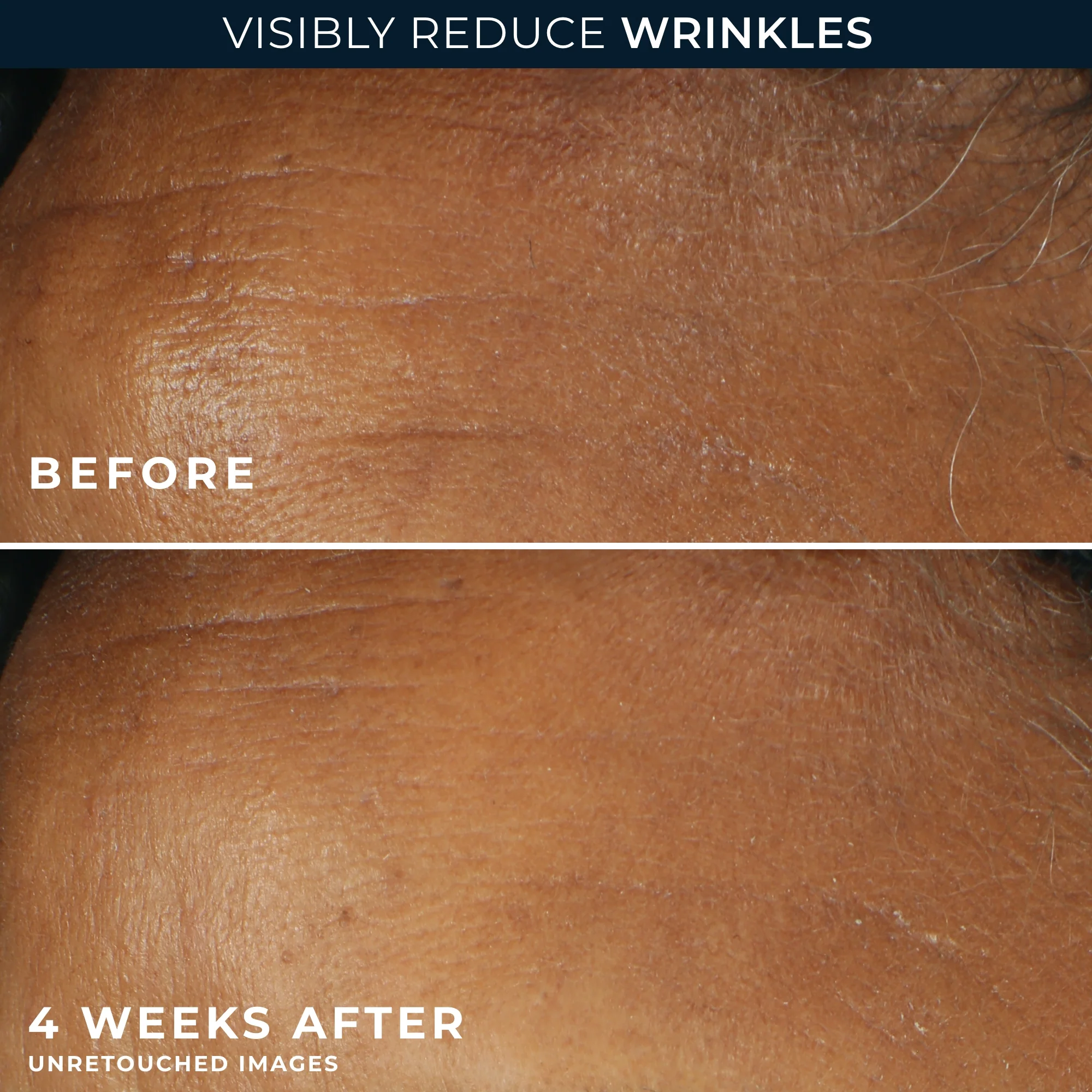 RETINOL CORREXION® Deep Wrinkle Daily Moisturizer SPF 30 - Image 5