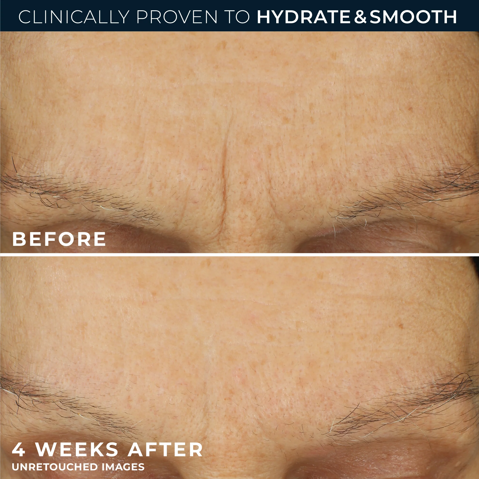 RETINOL CORREXION® Line Smoothing Max Hydration Cream - Image 5